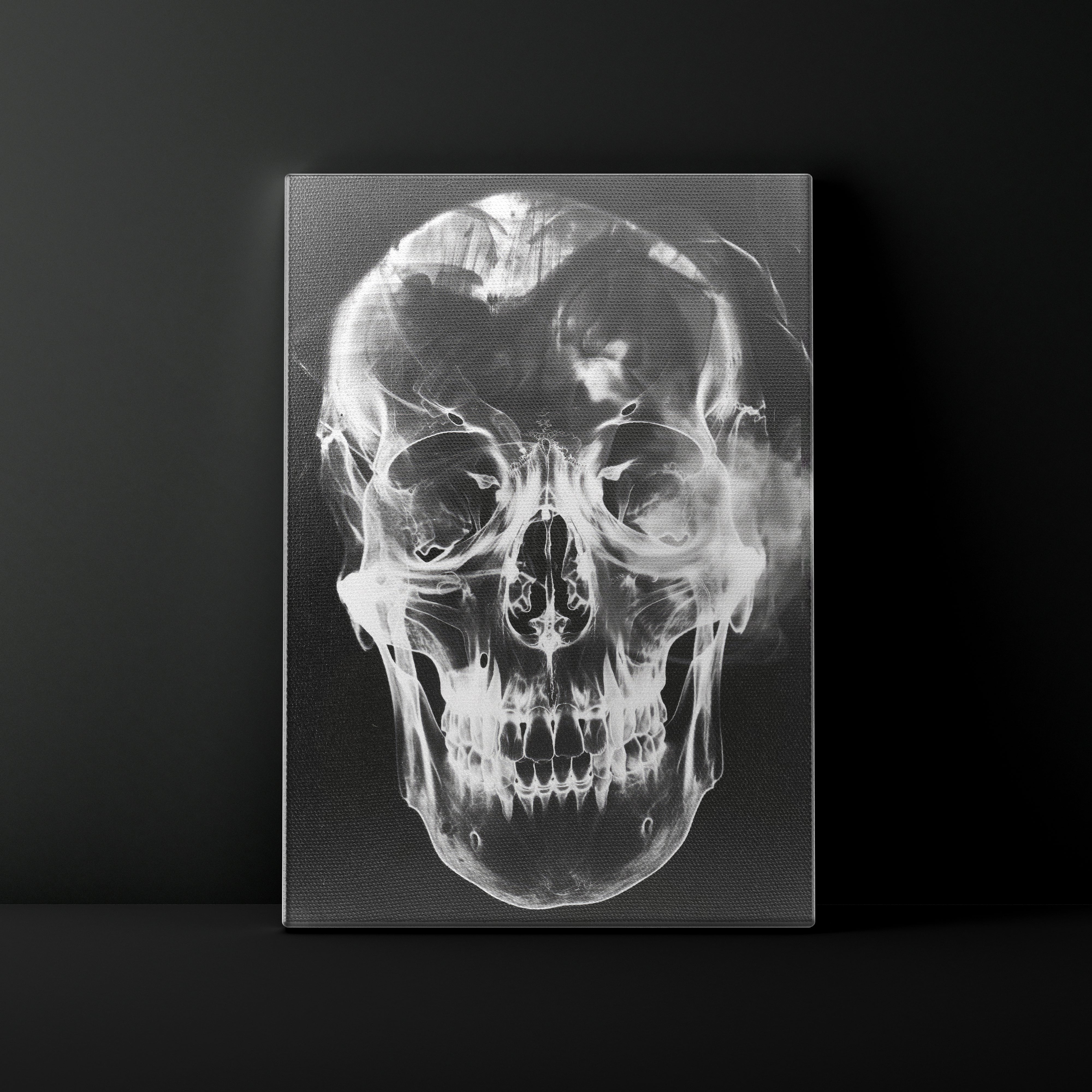 X-ray image of a skull on a black background