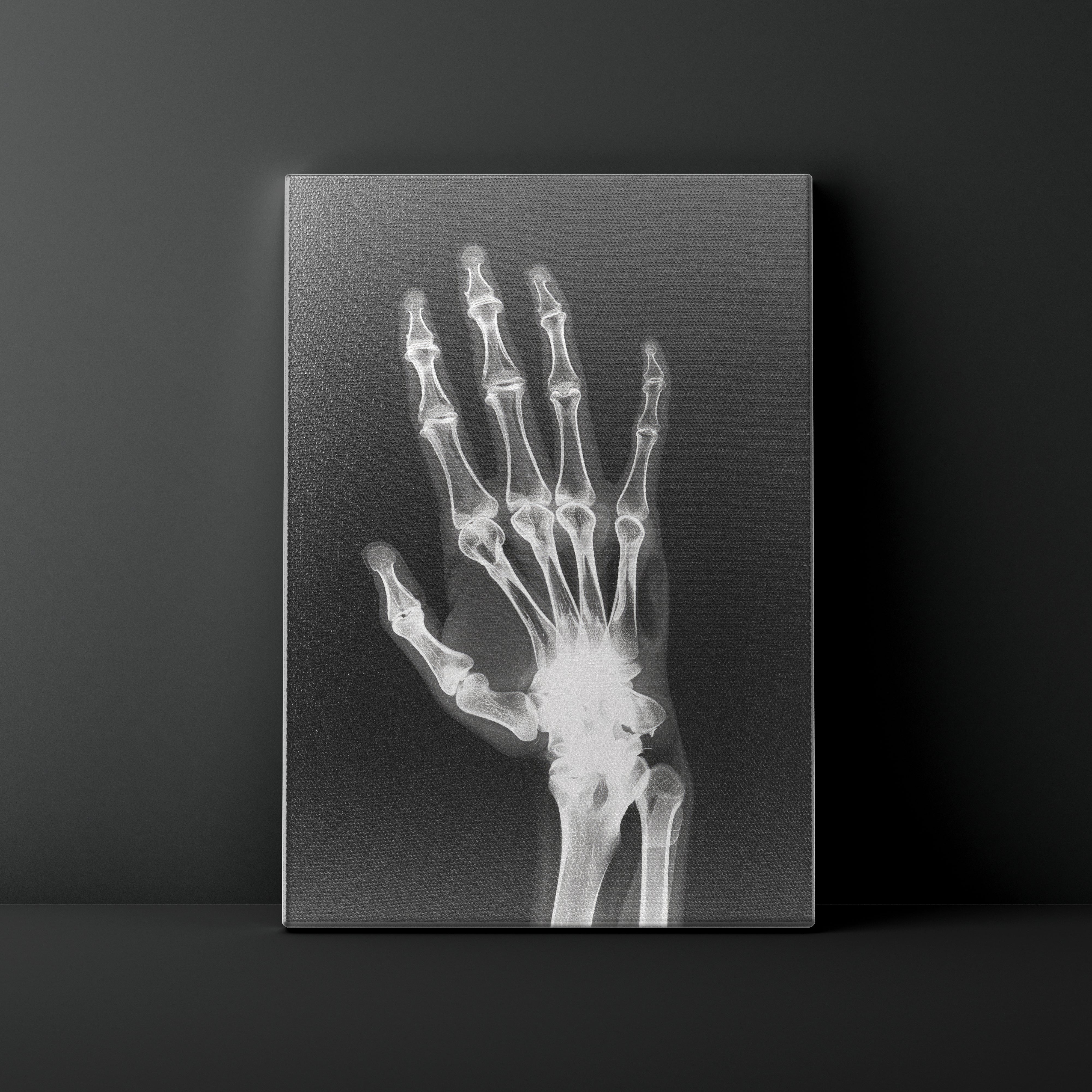 X-ray image of a hand on a dark background